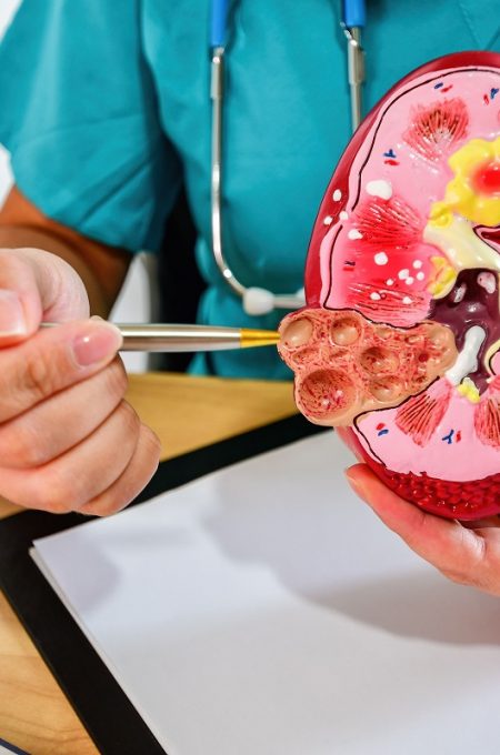 A closeup of a Doctor analyzing of patient kidney health using a kidney anatomical model